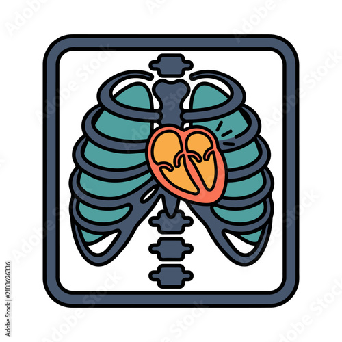 Mechanical Heart Valve Fluoroscopy Icon for Cardiology