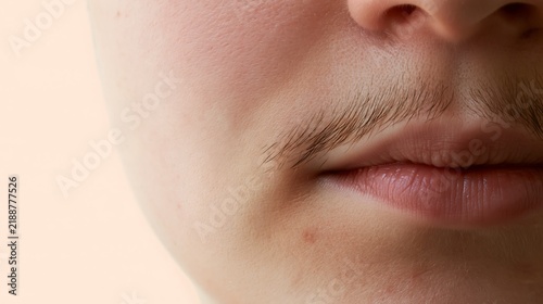 Close-up of unwanted facial hair above a woman’s upper lip, illustrating hormonal changes and female hirsutism for women’s health, skincare and hair removal topics