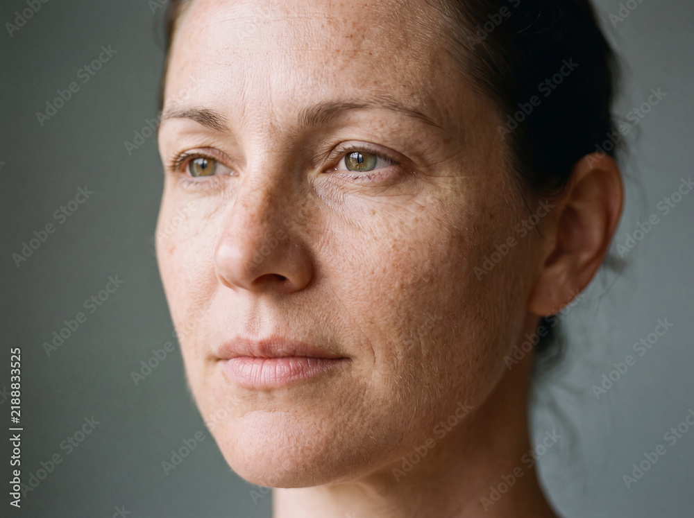 Fototapeta premium Sun Damage and Signs of Skin Aging