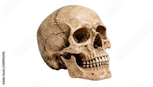 Quadro su tela Cracked human skull with visible teeth and sutures, isolated on transparent back