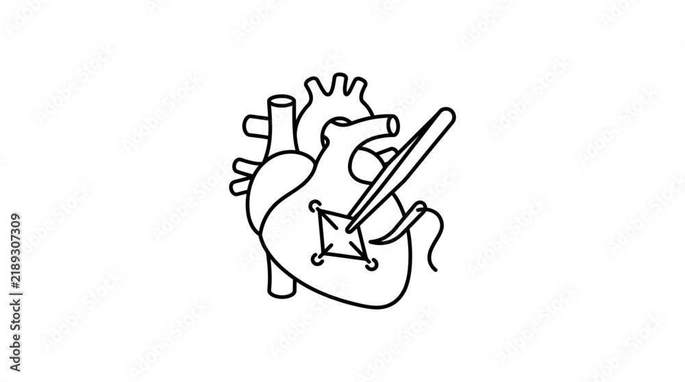 Obraz premium Heart surgery symbol, isolated on transparent background