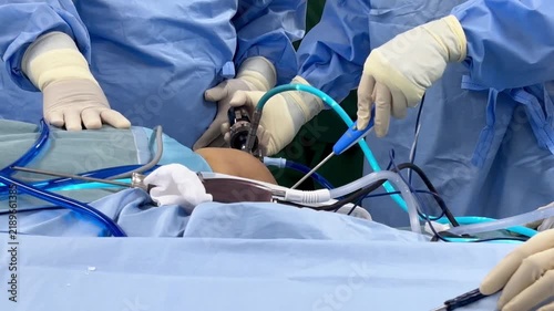 A team of doctor or surgeon did surgery inside operating room in hospital.People holding medical equipment or surgical tool in keyhole endoscopic surgery.Minimal invasive joint arthroscopic procedure.