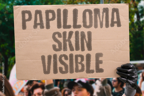 Konstfotografi "Papilloma skin visible" Papillomavirus causes visible surface lesions and growths