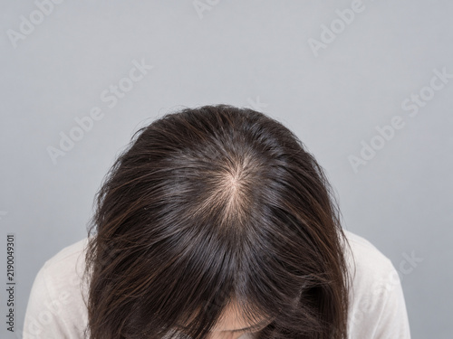 Fototapeta 前かがみになって頭頂部のつむじを見せる女性
