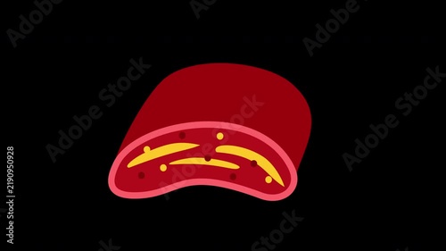 sickle hemoglobin cross section