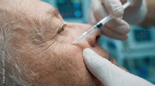 Close-up of a mature woman receiving an anti-aging cosmetic injection treatment for crow's feet wrinkles around the eye.