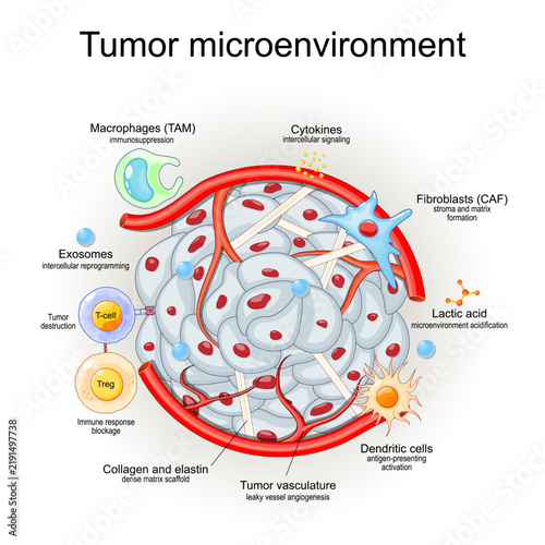 Tumor microenvironment TME. Cellular diagram cancer cells, CAFs, TAMs, angiogenesis, and immunosuppressive stroma.