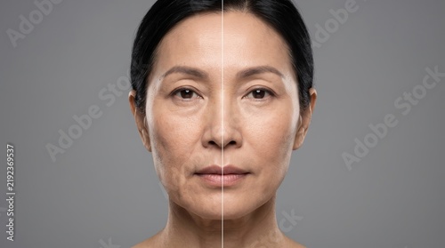 Split Screen Comparison of Asian Woman Face Before and After Anti-Aging Skincare