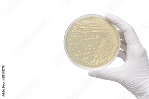 Fotografie Gloved scientist holding a Petri dish with bacterial colonies growing on agar, i