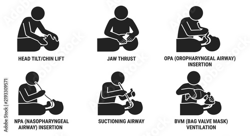 Medical procedure illustrations depict emergency airway management techniques