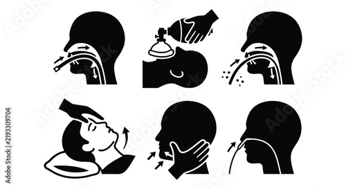 Medical procedure illustrations depict emergency airway management techniques