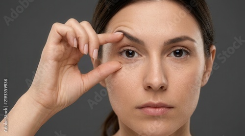 Young woman evaluating drooping upper eyelid skin for blepharoplasty preparation.