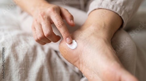 Moisturizing Cream Application on Dry Cracked Heel for Skin Care Treatment and Hydration at Home