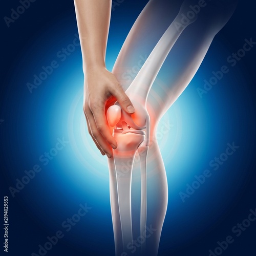3D Knee Joint Pain Visualization
