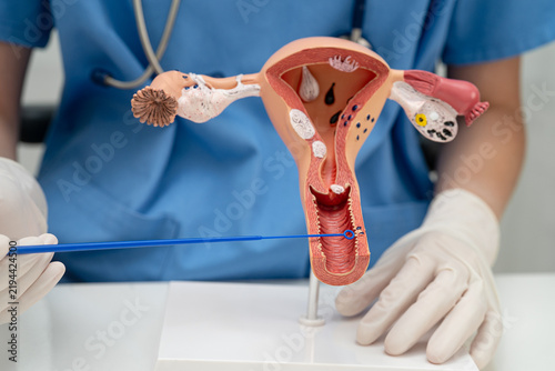 Fotografía Uterus, doctor holding human anatomy model for study diagnosis and treatment in hospital