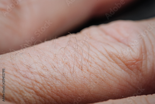 Fotografía Close-up view of human skin on a hand showing fine hair and texture, highlightin