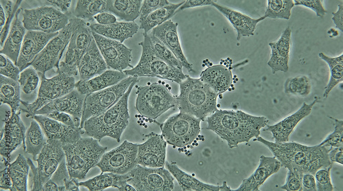 Cytopathic Syncytia Formation in RSV Infected Cell Culture