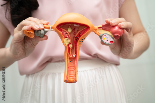 Cuadro en lienzo Uterus, Asian woman holding human anatomy model.