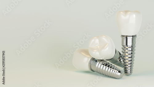 Cuadro en lienzo 3D rendering of dental implant structure, medical teeth implant, design of denti