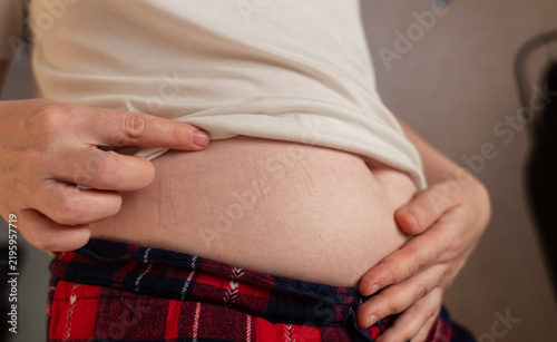 Photography Woman touching stretch marks on belly skin