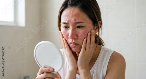 A young woman examines her skin with a handheld mirror displaying visible redness and skin irritation blemishes complexion cosmetic cutaneous