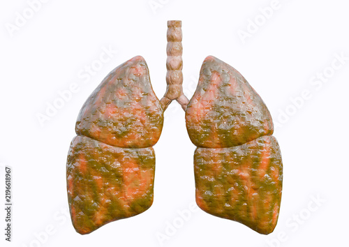 Diseased human lungs showing abnormal tissue and harmful damage, isolated on a white background.