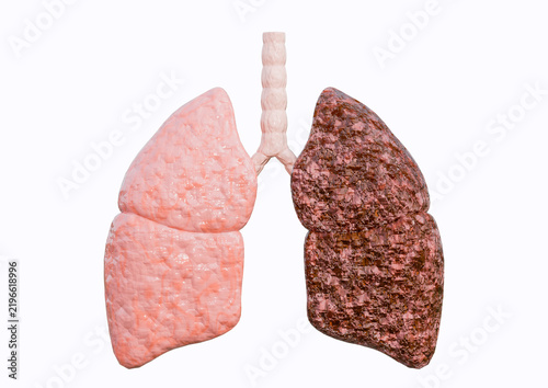 Human lung representing chronic obstructive pulmonary disease COPD , showing both preserved and altered lung tissue, isolated on a white background.
