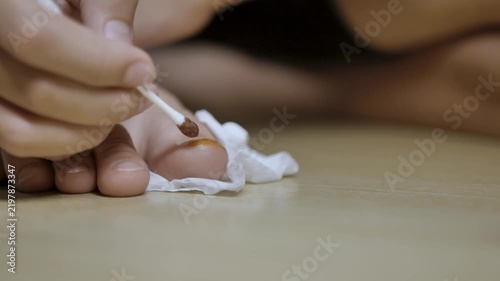 Hands applying medicine to toenail with cotton swab closeup treatment at home