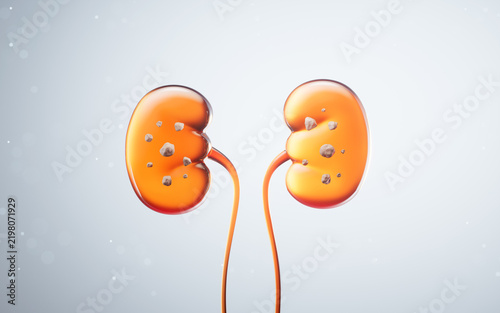 Kidney stone with biology and health care concept, 3d rendering.