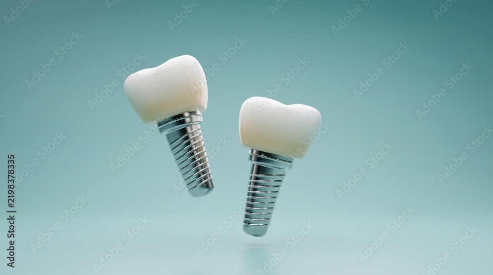 Fototapeta premium 3d render of two realistic dental implants with white crowns floating against soft blue studio background for clinic advertising.