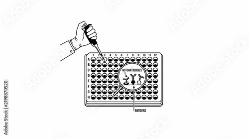 Black and white laboratory vector illustration of a microplate ELISA test with a pipette adding sample, showing autoantibodies and antigens.