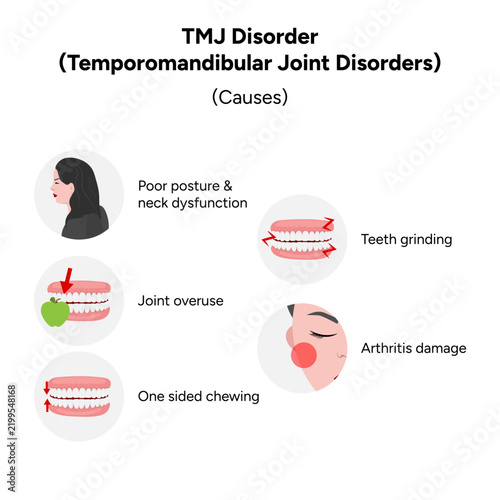 Detailed hand-drawn dental medical illustration explaining the common causes of temporomandibular joint disorder (TMJ disorder). The artwork presents contributing factors such as jaw trauma