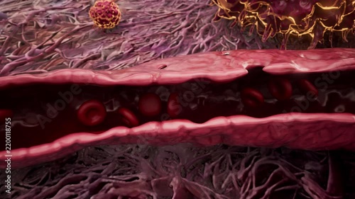 Conceptual 3D animation of cancer cells metastasizing through a blood vessel