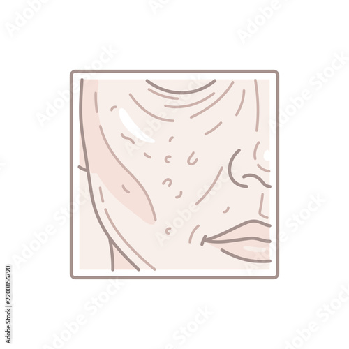 Close-up illustration of skin with acne and pores