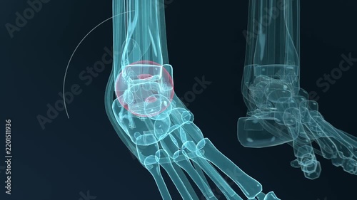 Animating x-ray ankle rotating fanning and reforming on playback in lab showing tibia talus joint