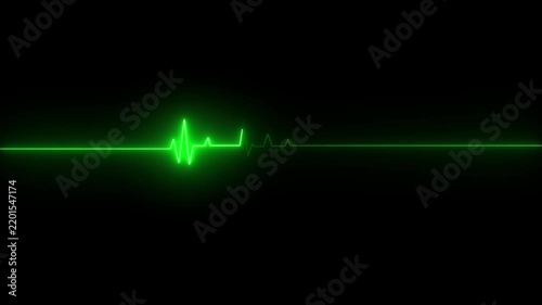 Green digital heartbeat monitor line pulsing on a black background