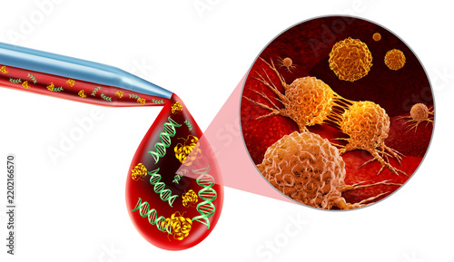 Early Detection of Multiple Cancers and Multi cancer early detection or MCED as a liquid biopsy or cancer screening as early tumor detection