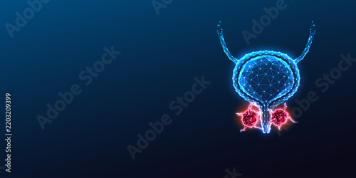 Prostate Cancer and Male Reproductive Oncology Medical Concept Vector
