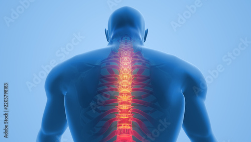 Spine Pain With Highlighted Vertebrae In Human Back