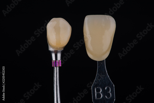 Single dental zirconia crown of premolar on a titanium base compared to shade B3