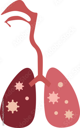 Pneumonia Illustration