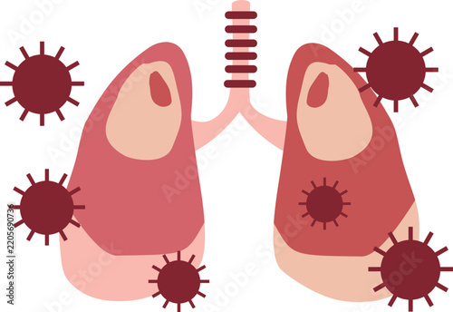 Pneumonia Illustration