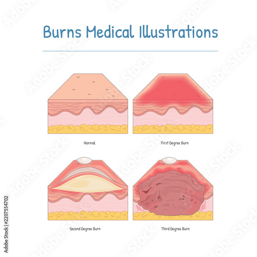 Burns Medical Collections