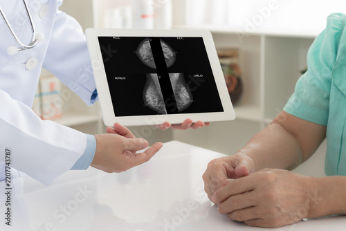 Breast Surgeon doctor looks result of mammography to screen diagnose breast from mammogram test at medical center.