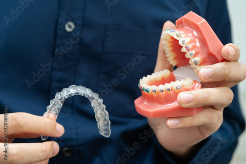 Man holding invisible aligner orthodontic retainer for dental teeth straightening.