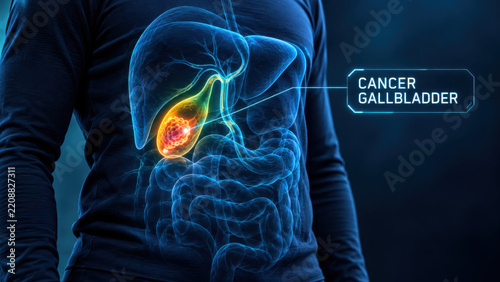 Gallbladder cancer awareness through glowing medical illustration on human torso highlights diagnosis and digestive organ health for healthcare education and patient support
