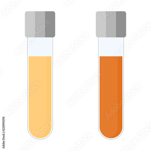 Urine sample tube set with a lid for kidney exam, urinary tract infection and cystitis diagnostics. Medical vector illustration.