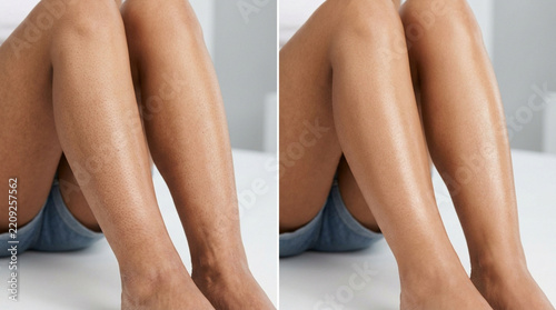 Skin transformation: Before and after leg hair removal
