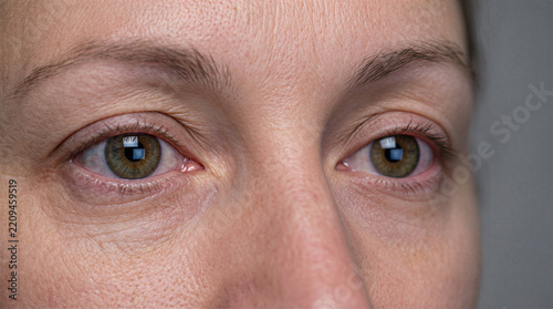 Digital Fatigue Stressed Woman Eye Close Up Screen Reflection Health Exhaustion Mental Burnout Technology Overuse Tired Eyes Strain Lifestyle Concept Tiredness From Computer Work Overexposure Screen