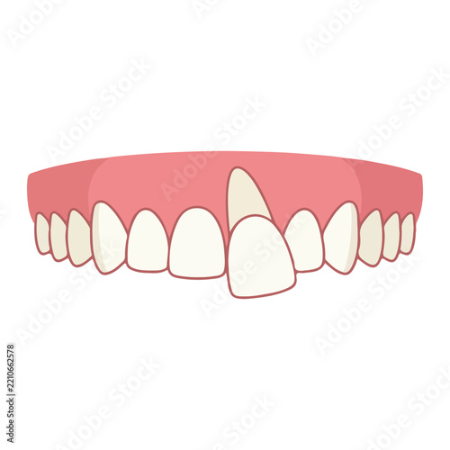 Crooked misaligned dental teeth and gums for orthodontic oral health care